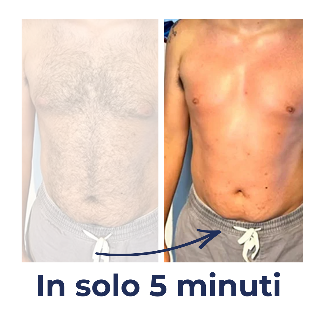 Dermaprime - La soluzione Professionale per la depilazione degli uomini